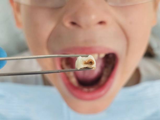 Best Urgent Dental Care in Woodway, TX