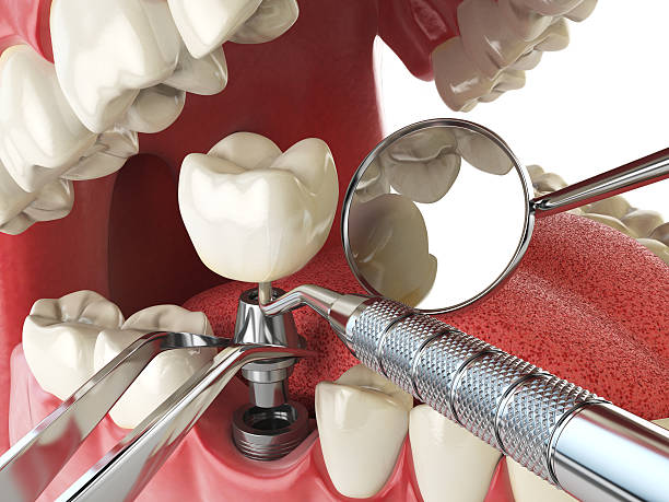 Best Emergency Broken Tooth Repair in Woodway, TX