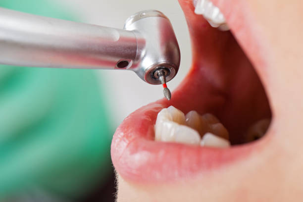 Best Emergency Broken Tooth Repair in Woodway, TX